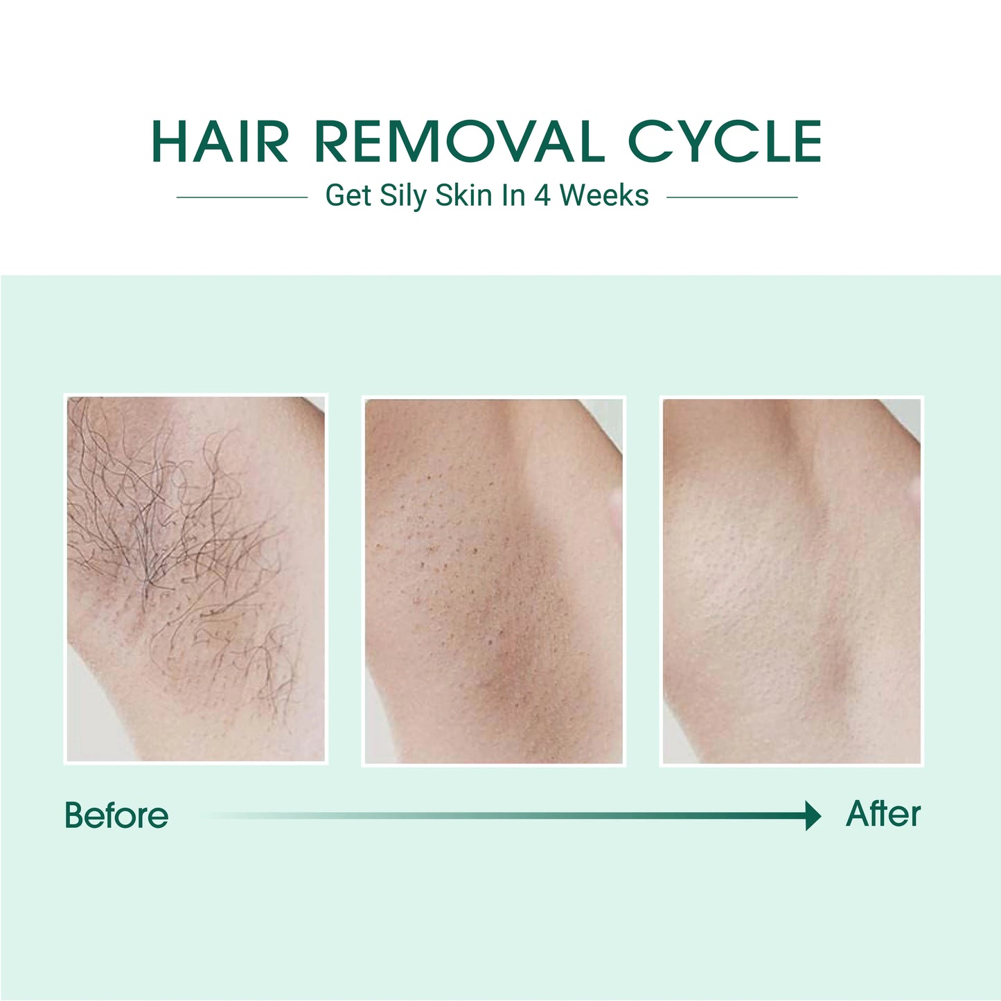 .Laser IPL Hair Removal